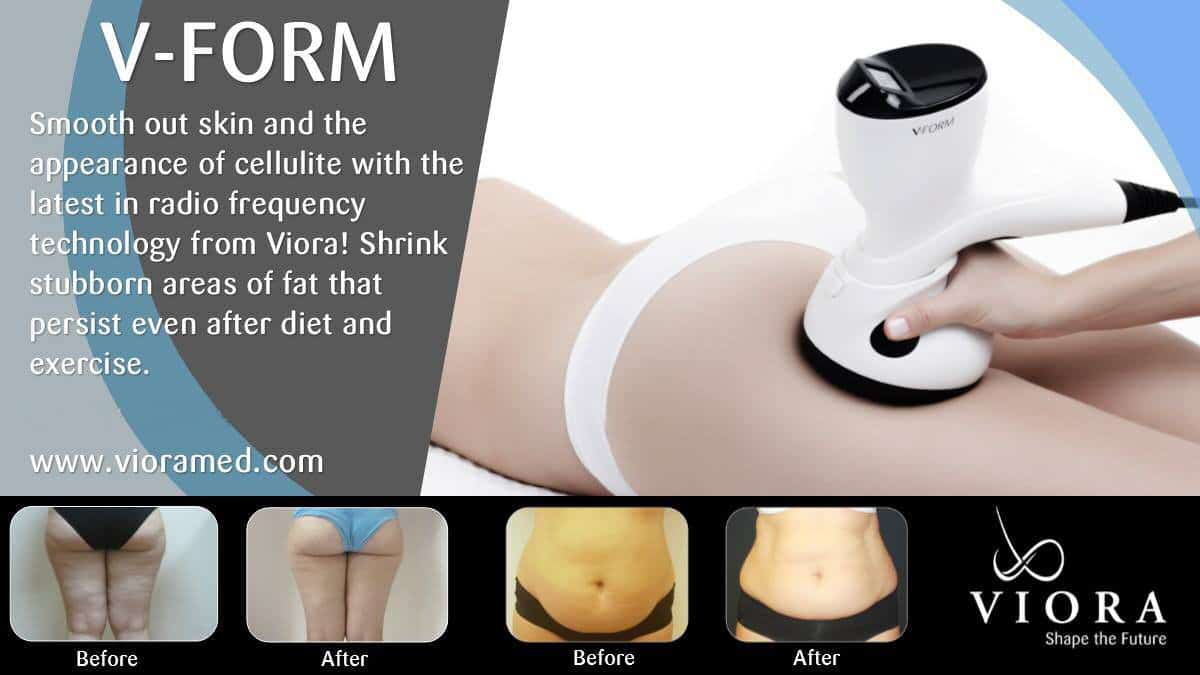 V-Form Body Contouring by Tourmaline Skin Care & Laser